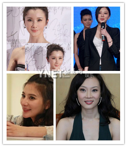 盤點女星整容成敗 陳數整容變臉五官似孫儷