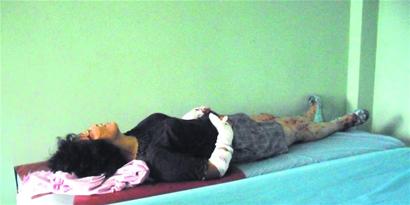 養8年寵物狗把主人咬成重傷 因天熱發狂