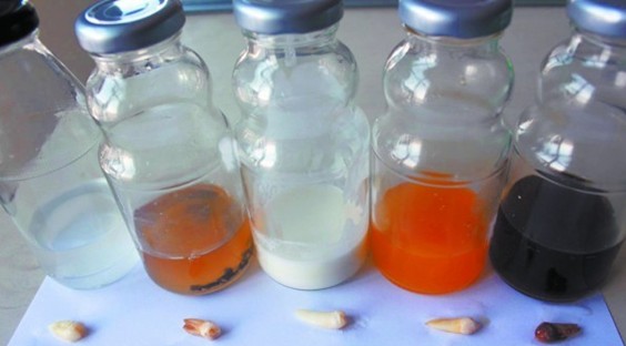 喝啥飲料最傷牙 實驗證實可樂損傷牙釉質 喝啥飲料最傷牙 實驗證實可樂損傷牙釉質