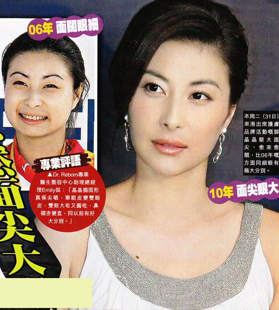 準闊太郭晶晶優雅照曝光盡顯貴氣 為嫁豪門瘋狂整容