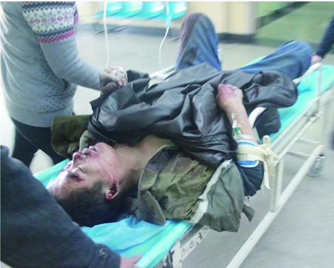 工人摔下腳手架顱骨塌陷 負(fù)責(zé)人竟笑稱小事 工人摔下腳手架顱骨塌陷 負(fù)責(zé)人竟笑稱小事