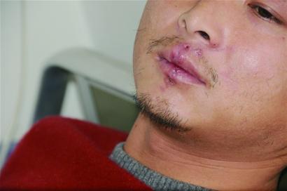 垛墻突倒塌 工人被“活埋” 垛墻突倒塌 工人被“活埋”