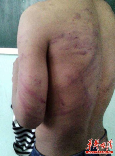 目前被體罰學生已經回校上課,涉事老師被責令道歉。網絡截圖